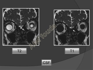 MRI for the maxillofacial surgeon. | PPSX