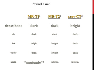 MR-T11 MR-T21 xray-CT2
dense bone dark dark bright
air dark dark dark
fat bright bright dark
water dark bright dark
brain "anatomic"3 interm. interm.
Normal tissue
 