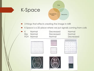 K-Space
 3 things that effects creating the image in MRI
 K-Space is a 2D place where we put signals coming from coils
 K Normal Decreased Normal
Res Normal Decreased Normal
FOV Normal Normal Decreased
Time
Resolution
Signal/Noise
Ratio
 