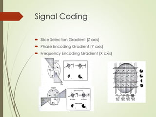 Signal Coding
 Slice Selection Gradient (Z axis)
 Phase Encoding Gradient (Y axis)
 Frequency Encoding Gradient (X axis)
 