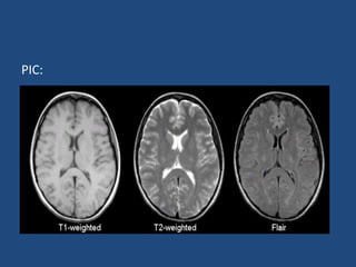 Presentation on MRI of human brain in detail | PPTX