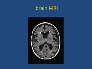 Presentation on MRI of human brain in detail | PPTX