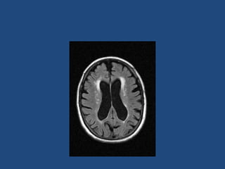 Presentation on MRI of human brain in detail | PPTX