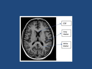 Presentation on MRI of human brain in detail | PPTX