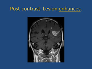 Presentation on MRI of human brain in detail | PPTX