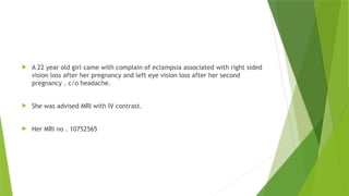  A 22 year old girl came with complain of eclampsia associated with right sided
vision loss after her pregnancy and left eye vision loss after her second
pregnancy . c/o headache.
 She was advised MRI with IV contrast.
 Her MRI no . 10752565
 