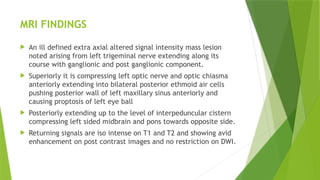 MRI FINDINGS
 An ill defined extra axial altered signal intensity mass lesion
noted arising from left trigeminal nerve extending along its
course with ganglionic and post ganglionic component.
 Superiorly it is compressing left optic nerve and optic chiasma
anteriorly extending into bilateral posterior ethmoid air cells
pushing posterior wall of left maxillary sinus anteriorly and
causing proptosis of left eye ball
 Posteriorly extending up to the level of interpeduncular cistern
compressing left sided midbrain and pons towards opposite side.
 Returning signals are iso intense on T1 and T2 and showing avid
enhancement on post contrast images and no restriction on DWI.
 