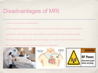 Disadvantages of MRI
Can be very expensive and unaffordable
Can be dangerous for patients with metallic devices placed within the body such as pacemakers
Performed in small spaces which will be difficult to be performed on claustrophobic patients
Movement during scanning may cause blurry images, so the patient must lie still during the scan.
RF transmitters can cause severe burns if misused or mishandled.

Claustrophobia as a result of closed MRI machines

Pacemakers and other metallic devices are not permitted

RF (radio frequency) power should be used with caution

 