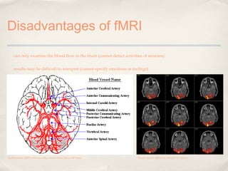 Disadvantages of fMRI
can only examine the blood flow in the brain (cannot detect activities of neurons)
results may be difficult to interpret (cannot specify emotions or feelings)

Unfortunately, fMRI scans can only examine blood flow in the brain

Results may be difficult to interpret or analuze

 
