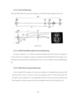 Fse Inversion Recovery Magnetic Resonance Imaging | DOCX