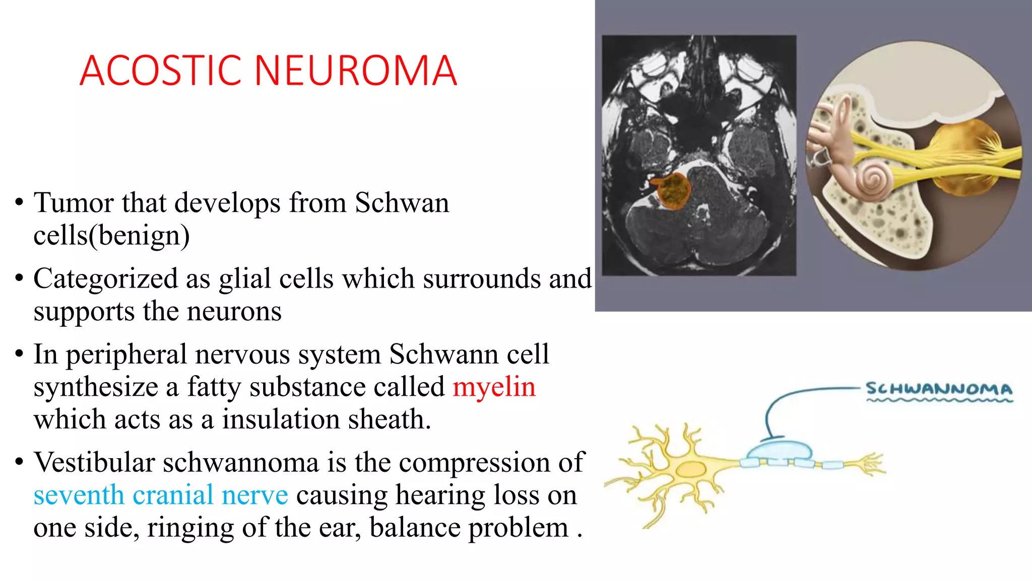 ACOSTIC NEUROMA
• Tumor that develops from Schwan
cells(benign)
• Categorized as glial cells which surrounds and
supports the neurons
• In peripheral nervous system Schwann cell
synthesize a fatty substance called myelin
which acts as a insulation sheath.
• Vestibular schwannoma is the compression of
seventh cranial nerve causing hearing loss on
one side, ringing of the ear, balance problem .
 