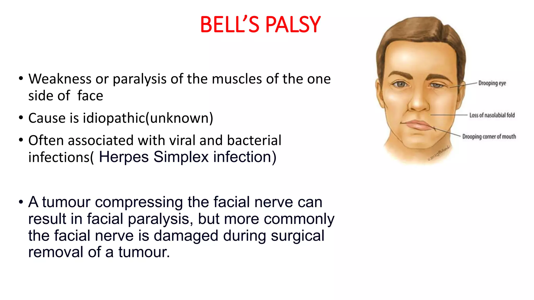 BELL’S PALSY
• Weakness or paralysis of the muscles of the one
side of face
• Cause is idiopathic(unknown)
• Often associated with viral and bacterial
infections( Herpes Simplex infection)
• A tumour compressing the facial nerve can
result in facial paralysis, but more commonly
the facial nerve is damaged during surgical
removal of a tumour.
 