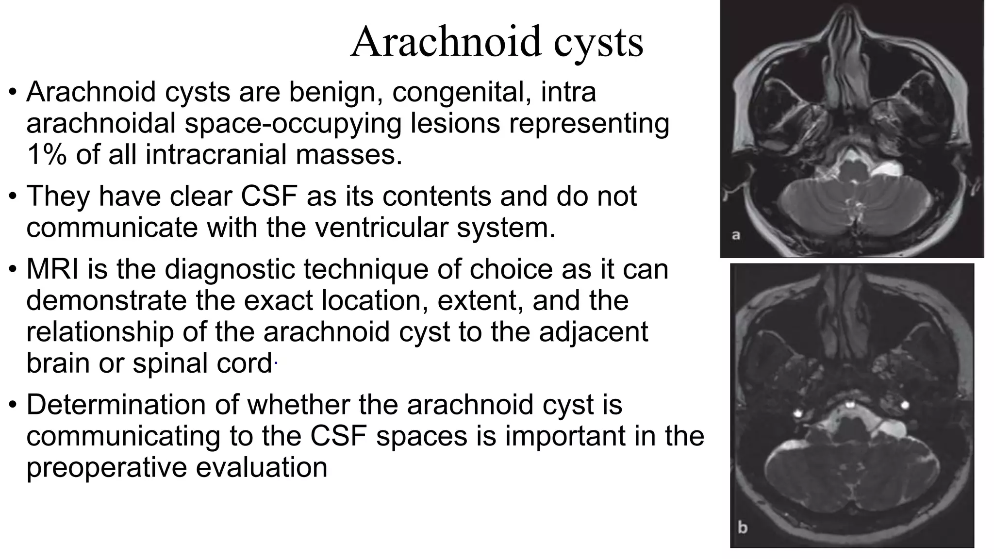 Arachnoid cysts
• Arachnoid cysts are benign, congenital, intra
arachnoidal space-occupying lesions representing
1% of all intracranial masses.
• They have clear CSF as its contents and do not
communicate with the ventricular system.
• MRI is the diagnostic technique of choice as it can
demonstrate the exact location, extent, and the
relationship of the arachnoid cyst to the adjacent
brain or spinal cord.
• Determination of whether the arachnoid cyst is
communicating to the CSF spaces is important in the
preoperative evaluation
 