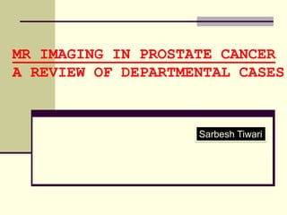 MR IMAGING IN PROSTATE CANCER
A REVIEW OF DEPARTMENTAL CASES



                    Sarbesh Tiwari
 