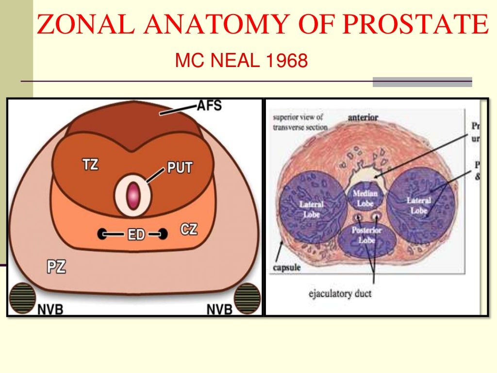 Mri prostate