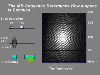 The MR Sequence Determines How k-space is Sampled... 90 180 view 1 192 The "spin-echo" 128 64 256 view 1 view 256 Frequency Slice selection 