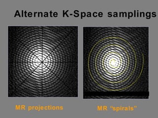 Alternate K-Space samplings MR projections MR “spirals” 