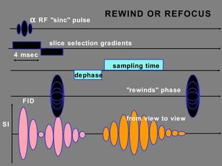 SI slice selection gradients FID    RF "sinc" pulse 4 msec sampling time dephase "rewinds" phase from view to view REWIND OR REFOCUS 