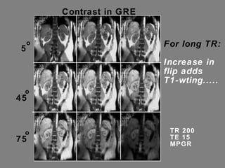 Contrast in GRE  TR 200 TE 15 MPGR 5 o 45 o 75 o For long TR: Increase in flip adds T1-wting..... 