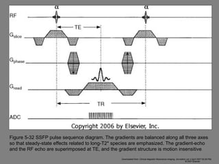 Figure 5-32 SSFP pulse sequence diagram. The gradients are balanced along all three axes so that steady-state effects related to long-T2* species are emphasized. The gradient-echo and the RF echo are superimposed at TE, and the gradient structure is motion insensitive . Downloaded from: Clinical Magnetic Resonance Imaging, 3rd edition (on 3 April 2007 05:38 PM) © 2007 Elsevier  
