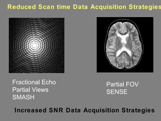 Reduced Scan time Data Acquisition Strategies Fractional Echo Partial Views SMASH Partial FOV SENSE Increased SNR Data Acquisition Strategies 