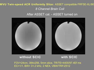 FOV=24cm, 384x256, 5mm slice, TR/TE=4400/97.4Ef ms EC=1/1, BW= 31.2 kHz, 2 NEX, VBW/TRF/Z512 WVU Twin-speed ACR Uniformity Slice:  ASSET compatible FRFSE-XL/90 After ASSET cal. - ASSET turned on without SCIC with SCIC 8 Channel Brain Coil 