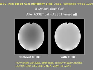 FOV=24cm, 384x256, 5mm slice, TR/TE=4400/97.4Ef ms EC=1/1, BW= 31.2 kHz, 2 NEX, VBW/TRF/Z512 WVU Twin-speed ACR Uniformity Slice:  ASSET compatible FRFSE-XL/90 After ASSET cal. - ASSET turned  off without SCIC with SCIC 8 Channel Brain Coil 