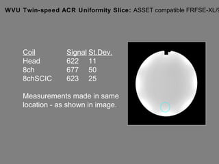 WVU Twin-speed ACR Uniformity Slice:  ASSET compatible FRFSE-XL/90 Coil Signal St.Dev. Head 622 11 8ch 677 50 8chSCIC 623 25 Measurements made in same  location - as shown in image. 