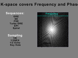 K-space covers Frequency and Phase Frequency Phase Sequences: GRE SE FSE Turbo GRE EPI Spiral Sampling VB 1/2NEX 1/2 Echo Key Hole 