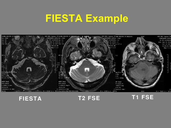 Mri Pulse Seqs