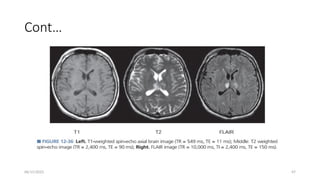 06/15/2025 47
Cont…
 