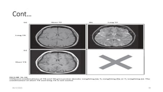 06/15/2025 58
Cont…
 