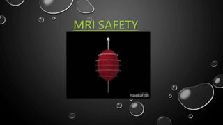 MRI SAFETY
 
