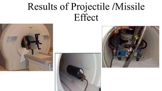 Mri Projectile Risk Mri safety sujan karki | PPTX
