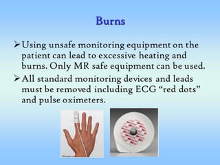 MRI Safety 