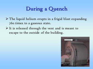 MRI Safety 