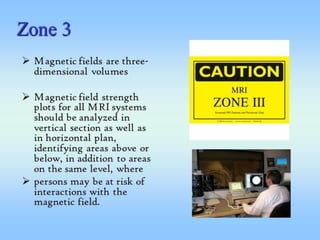 MRI Safety 