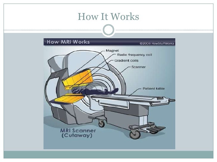 mri scans mri scan how it works
