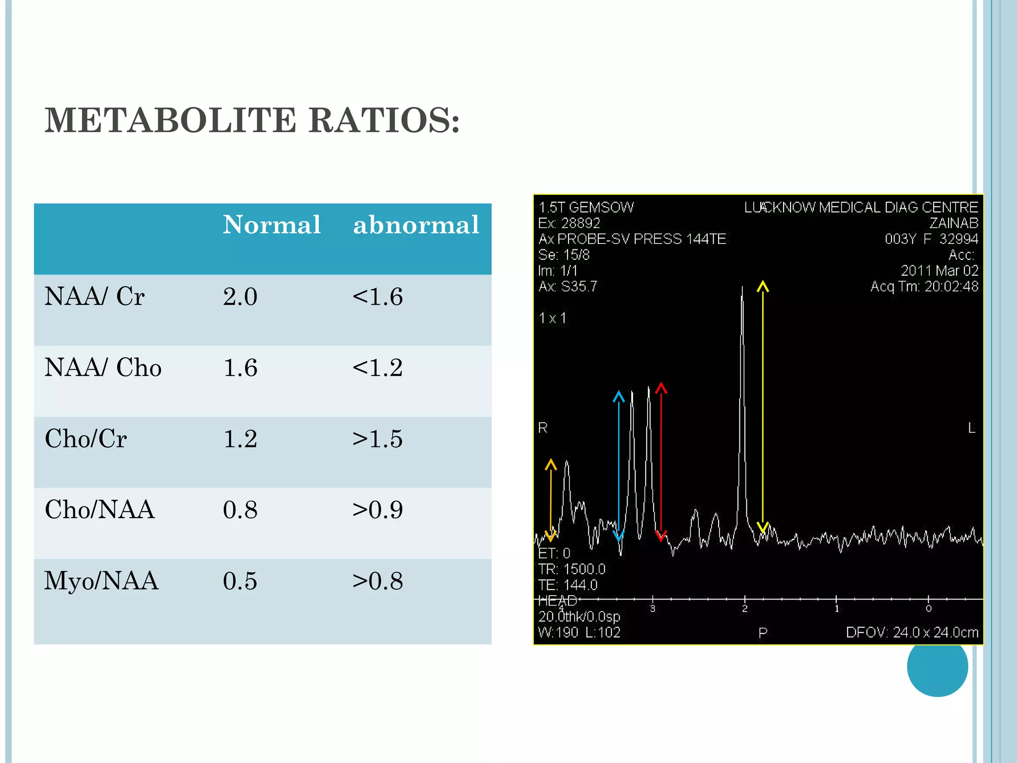 METABOLITE RATIOS:

           Normal   abnormal

NAA/ Cr    2.0      <1.6

NAA/ Cho   1.6      <1.2

Cho/Cr     1.2      >1.5

Cho/NAA    0.8      >0.9

Myo/NAA    0.5      >0.8
 