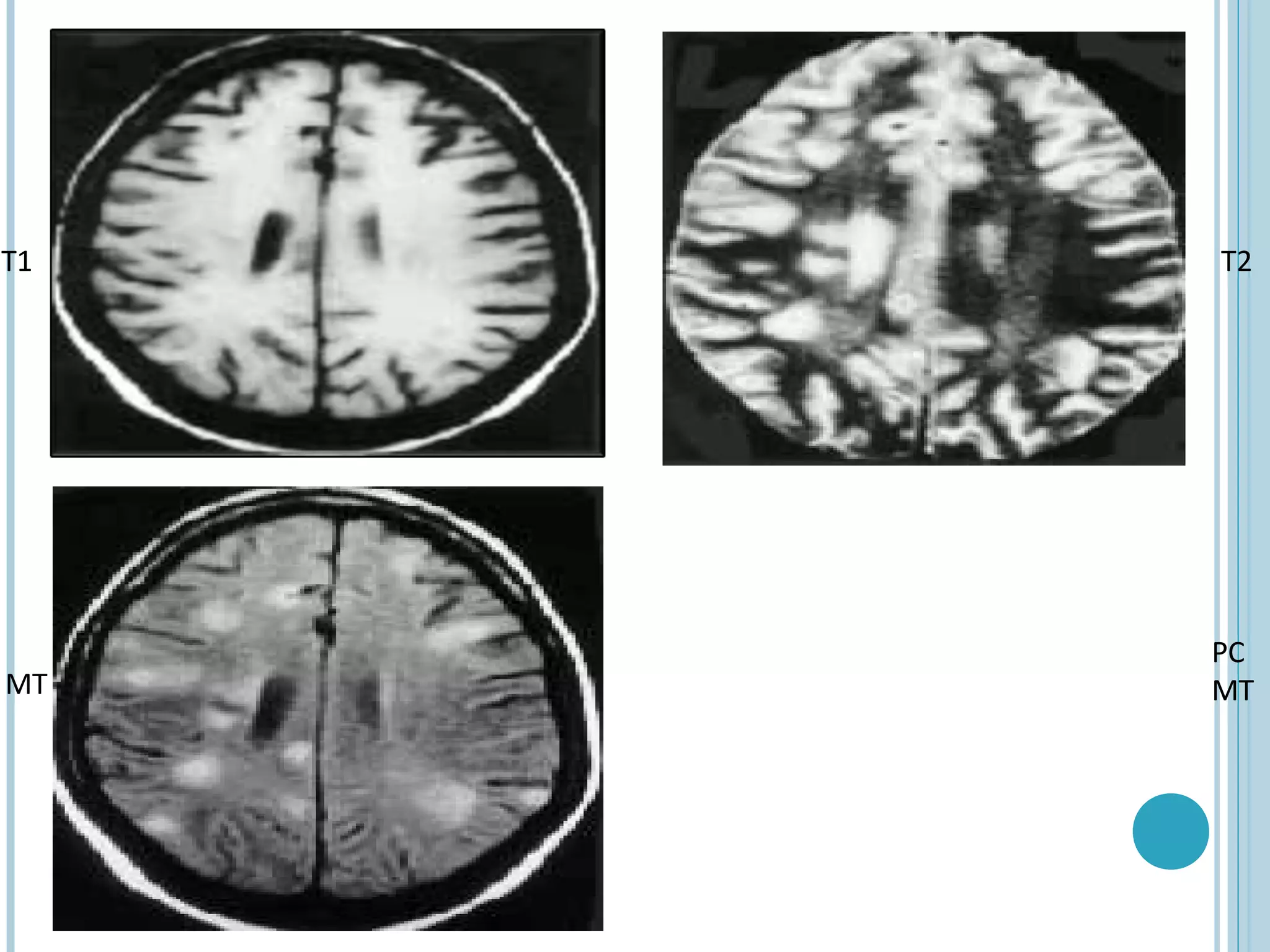 T1   T2




     PC
MT   MT
 