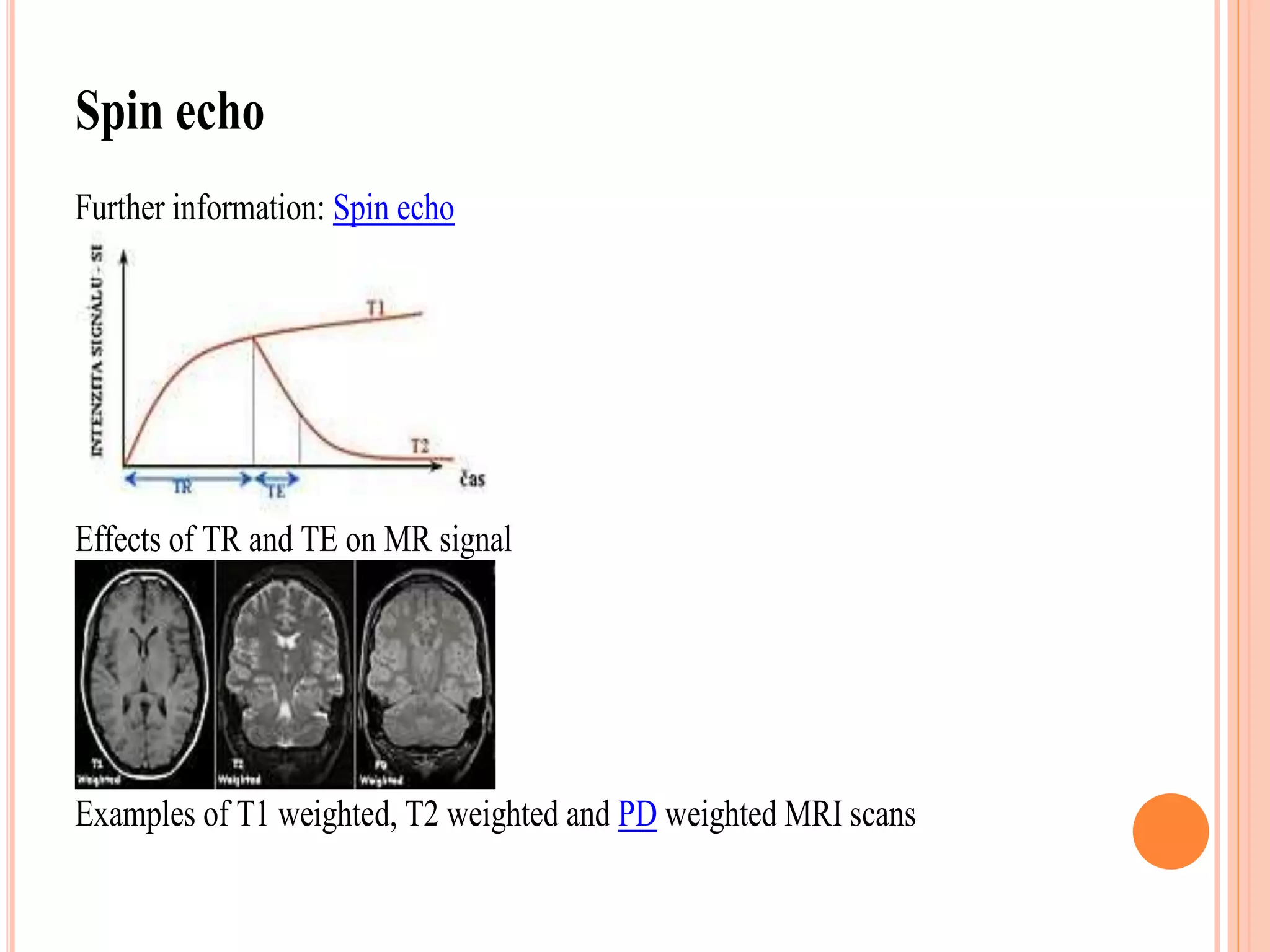 Spin echo
Further information: Spin echo
Effects of TR and TE on MR signal
Examples of T1 weighted, T2 weighted and PD weighted MRI scans
 