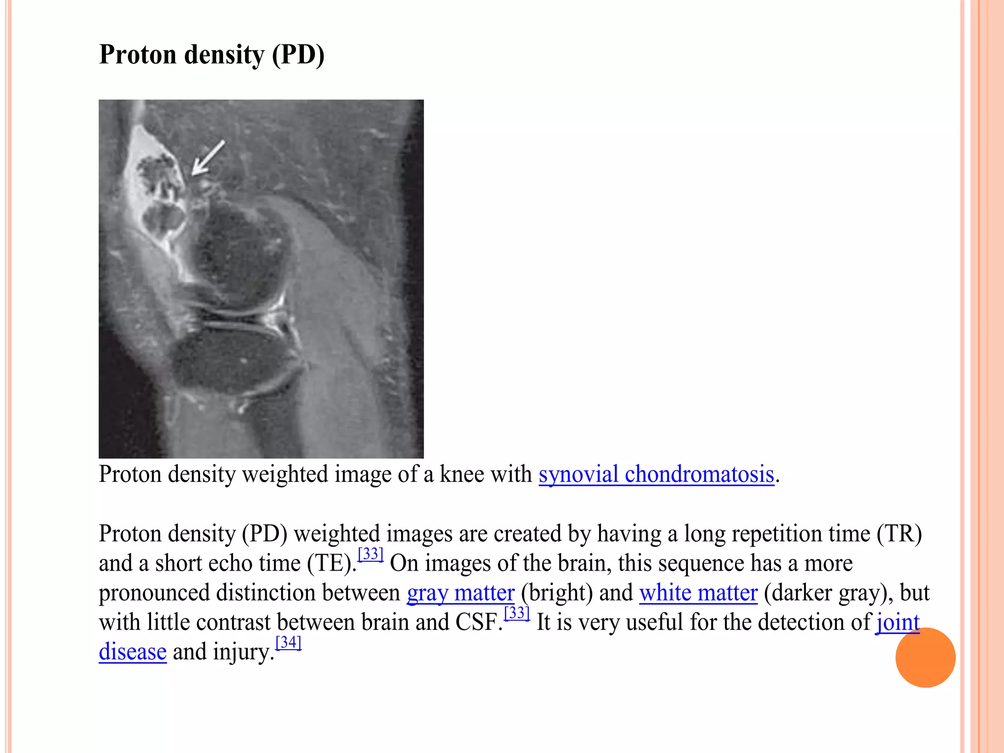 Proton density (PD)
Proton density weighted image of a knee with synovial chondromatosis.
Proton density (PD) weighted images are created by having a long repetition time (TR)
and a short echo time (TE).[33]
On images of the brain, this sequence has a more
pronounced distinction between gray matter (bright) and white matter (darker gray), but
with little contrast between brain and CSF.[33]
It is very useful for the detection of joint
disease and injury.[34]
 