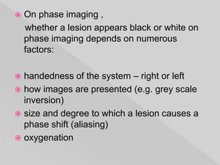  On phase imaging ,
whether a lesion appears black or white on
phase imaging depends on numerous
factors:
 handedness of the system – right or left
 how images are presented (e.g. grey scale
inversion)
 size and degree to which a lesion causes a
phase shift (aliasing)
 oxygenation
 