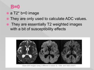 a T2* b=0 image
 They are only used to calculate ADC values.
 They are essentially T2 weighted images
with a bit of susceptibility effects
 