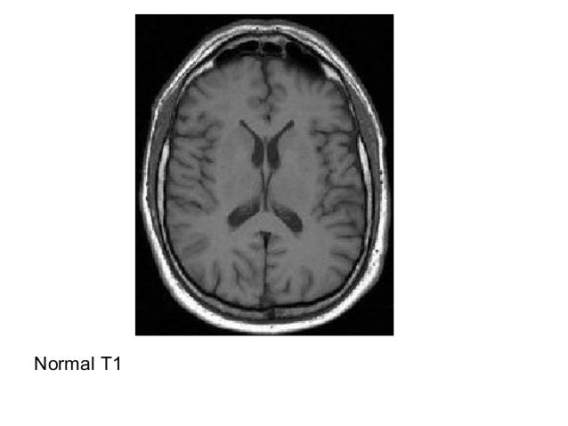MRI Sequences in Neuroradiology