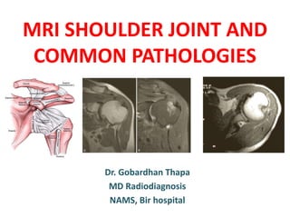 MRI SHOULDER JOINT AND
COMMON PATHOLOGIES
Dr. Gobardhan Thapa
MD Radiodiagnosis
NAMS, Bir hospital
 