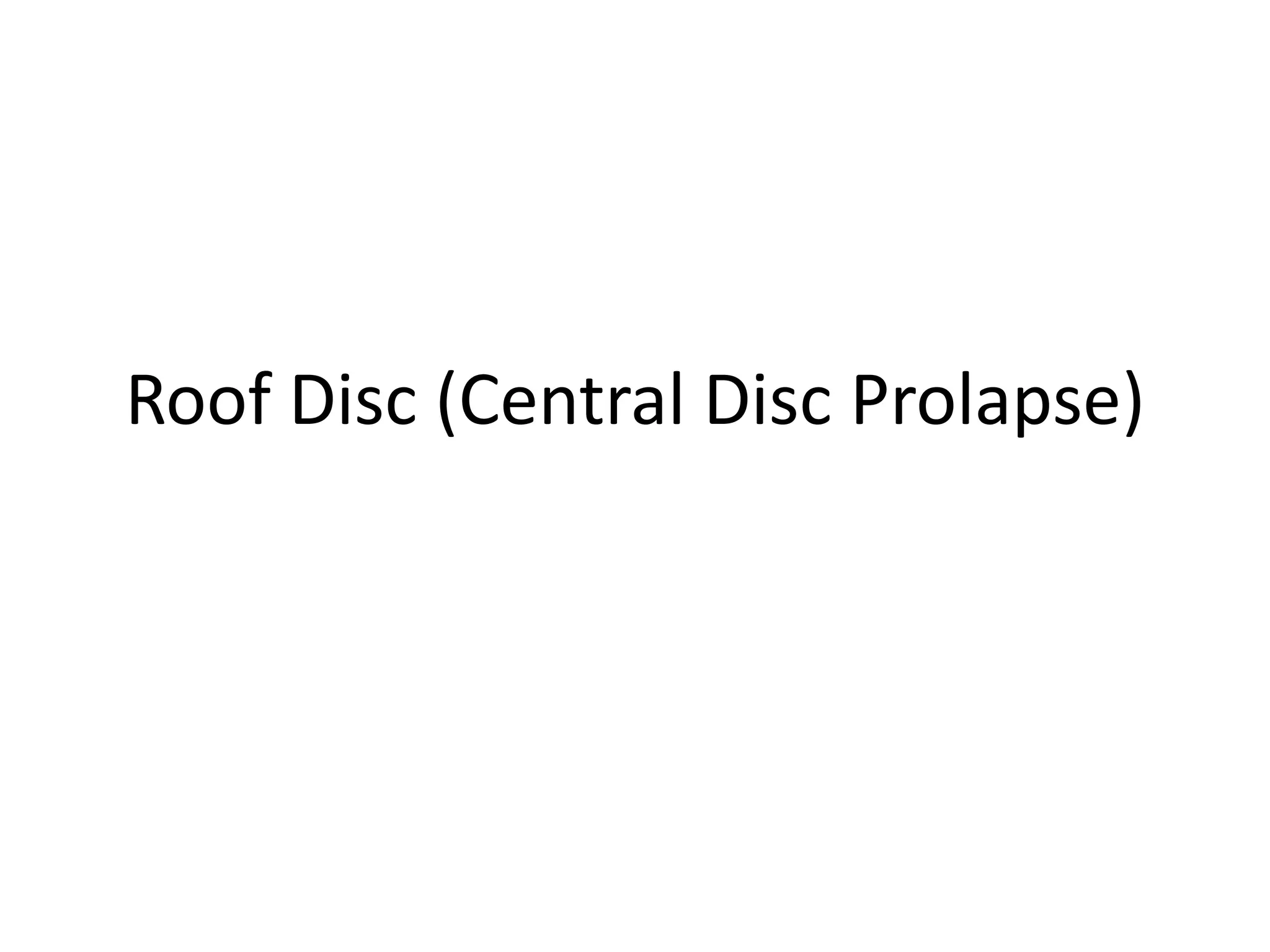 Roof Disc (Central Disc Prolapse)