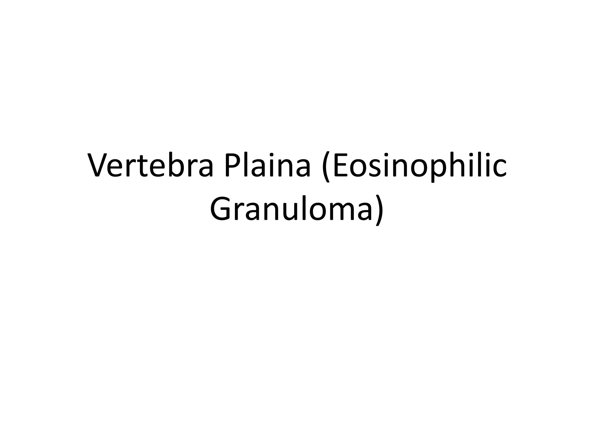 Vertebra Plaina (EosinophilicGranuloma)