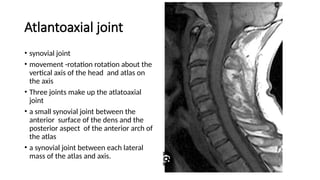 Magnetic resonance Imaging SPINE ANATOMY.pptx