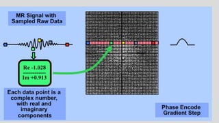 Mri spin echo pulse sequences its variations and | PPTX